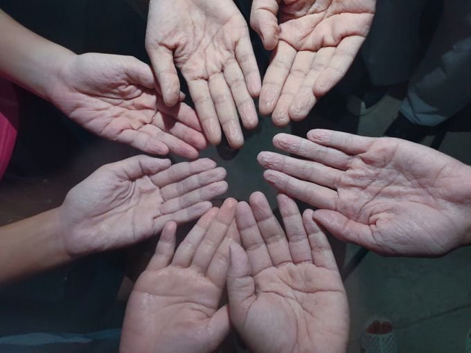 Wrinkled hands of sample collection staff in Bac Giang 3